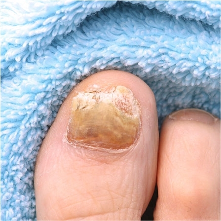 Teinture pour Onyxis Titania®, 10 ml