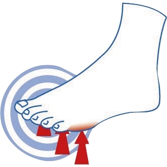 Coussinets plantaire Epitact®