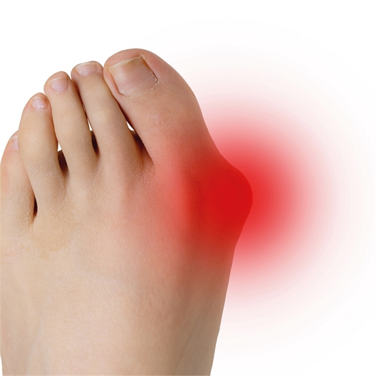 Lot de 2 redresse orteil hallux valgus