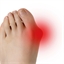 Lot de 2 redresse orteil hallux valgus